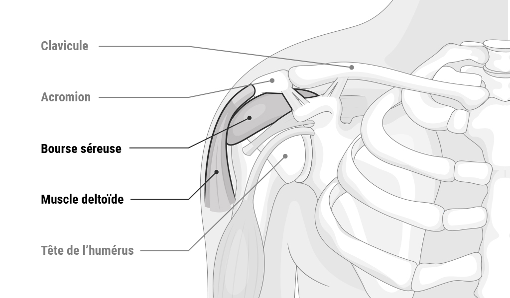 Illustration : épaule et texte Clavicule, Acromion, Bourse séreuse, Muscle deltoïde, Tête de l’humérus